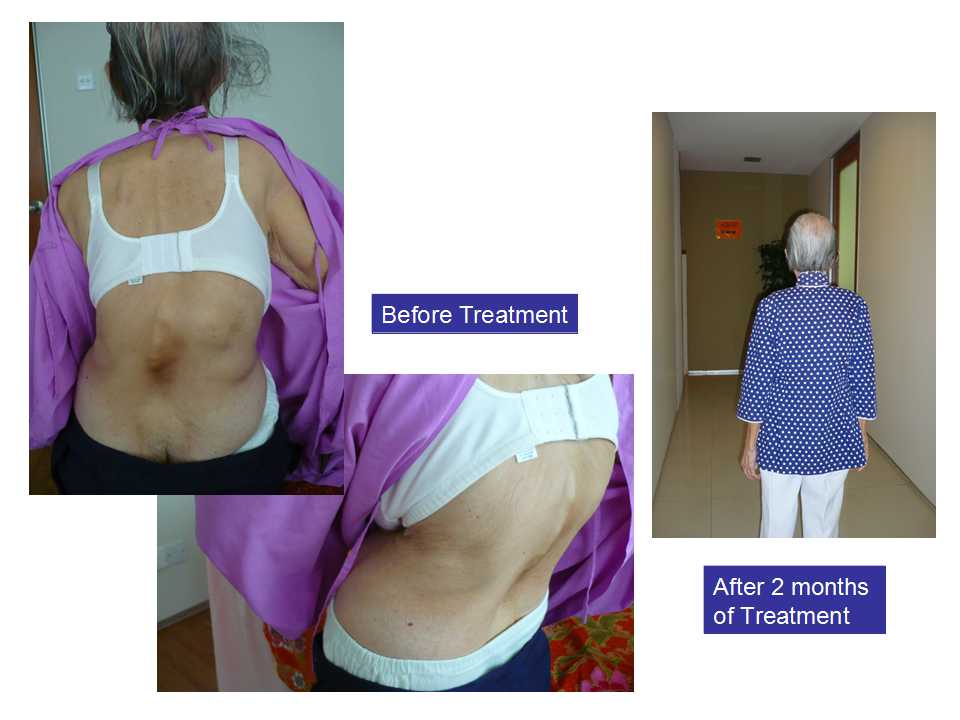 Result of WMQ treatment