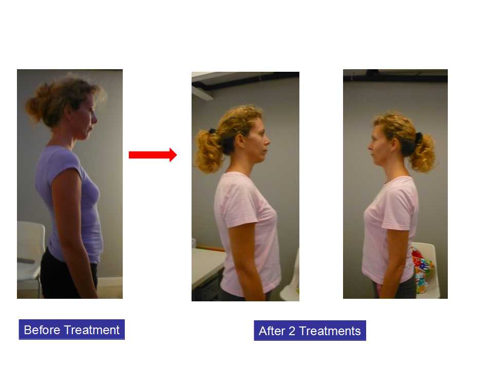 Result of WMQ treatment